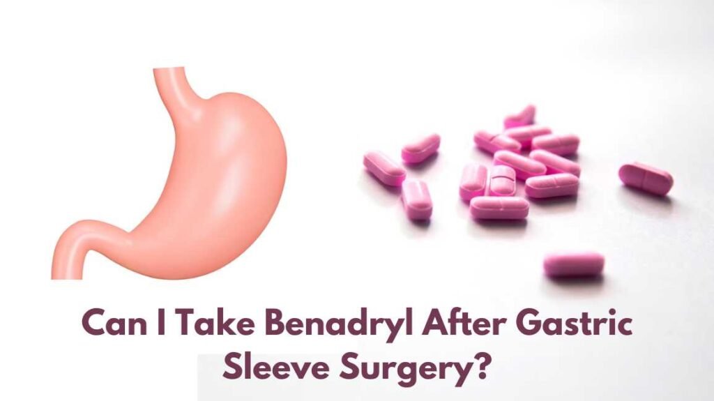 Can I Take Benadryl After Gastric Sleeve Surgery