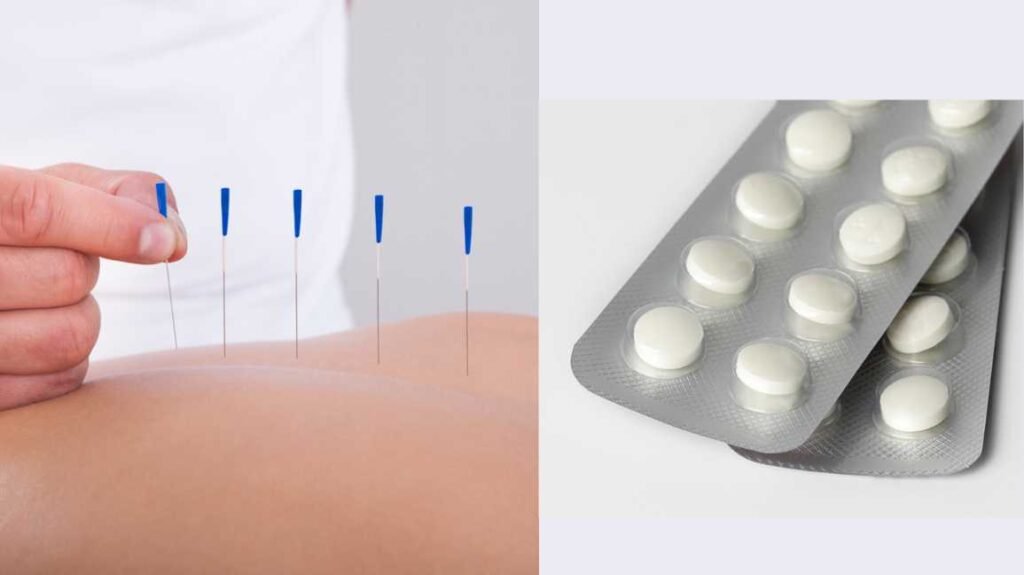 Can You Take Ibuprofen After Acupuncture