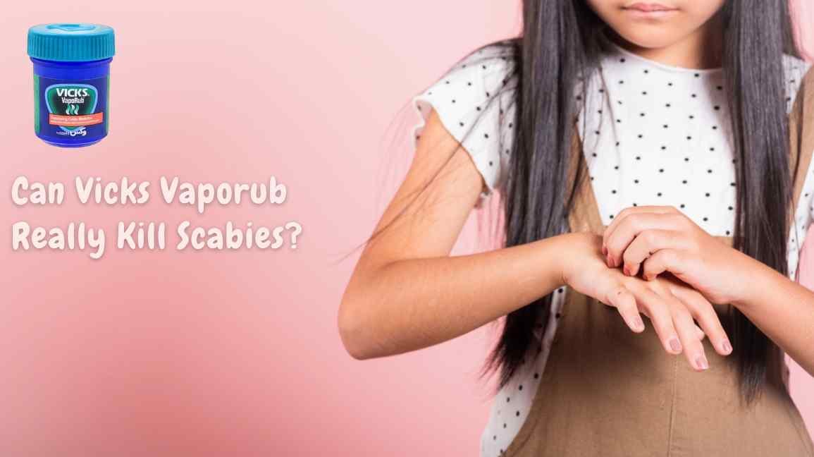 Can Vicks Vaporub Kill Scabies